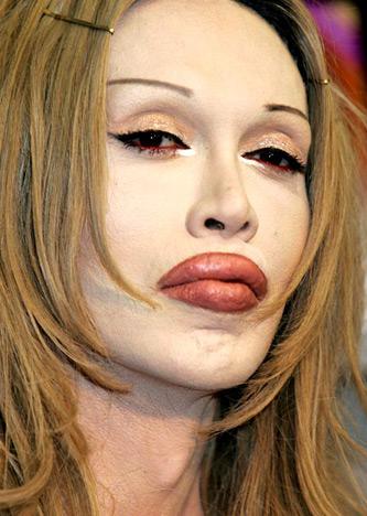 Pete Burns pa sho... Autors: sanity Plastic Surgery Nightmares!