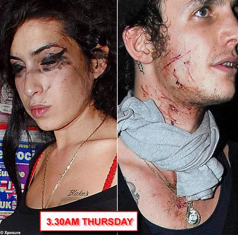 Amy Winehouse abgalvoka nav... Autors: UglyPrince Populārākie On & Off slavenību pāri