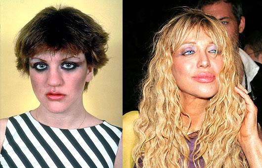 Courtney Love lūpu implanti... Autors: UglyPrince Plastiskā ķirurģija