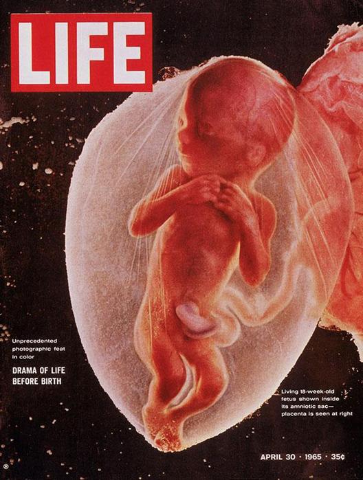 LIFE1965gada aprīļa numurs18... Autors: coldasice Labākie žurnalu vāki pēdējo 40 gadu laikā