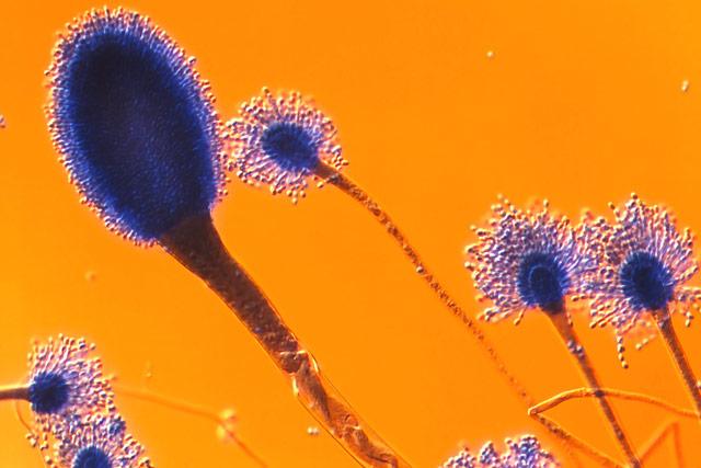 Aspergillus sp pelējuma sēnīte... Autors: Minx Mikroskopiskā pasaule