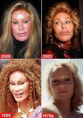  Autors: mazakuce Jocelyn Wildenstein