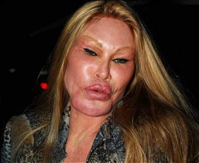  Autors: mazakuce Jocelyn Wildenstein