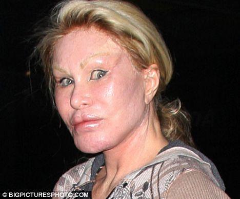  Autors: mazakuce Jocelyn Wildenstein