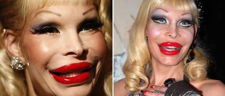 Amanda Lepore  Reiz nabadzības... Autors: ruutel Plastiskās operācijas