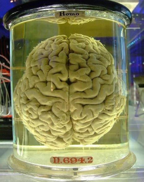 Smadzenes vidēji sver ap 13 kg Autors: Moonwalker Fakti par smadzenēm