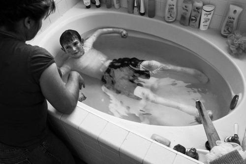  Autors: agonywhispers Amerikāņu zēns dzīvo bez ādas