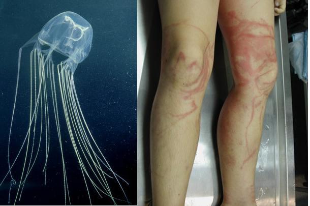 Box jellyfish kastes... Autors: Fosilija Dzīvnieku toksīni