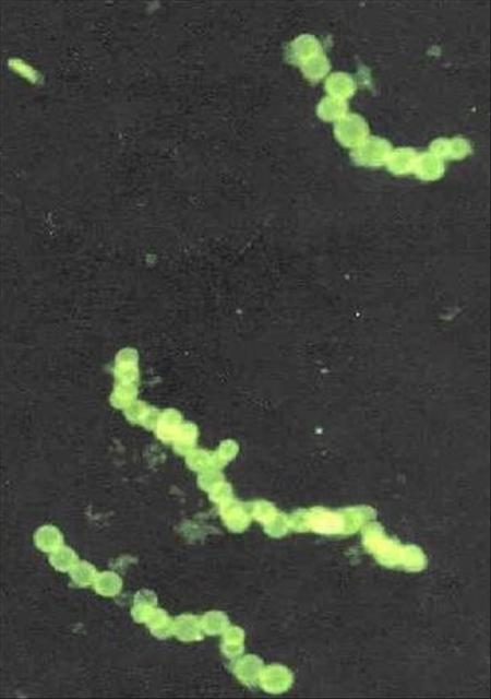 Pasaules lielākā baktērija... Autors: edjix Vai tu zināji(baktērijas)