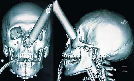 Šis notikums notika naktsklubā... Autors: rozazilonis Neticami X-RAY.