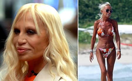 Donatella Versace ir ko... Autors: una puna 10 sliktākās plastiskās operācijas