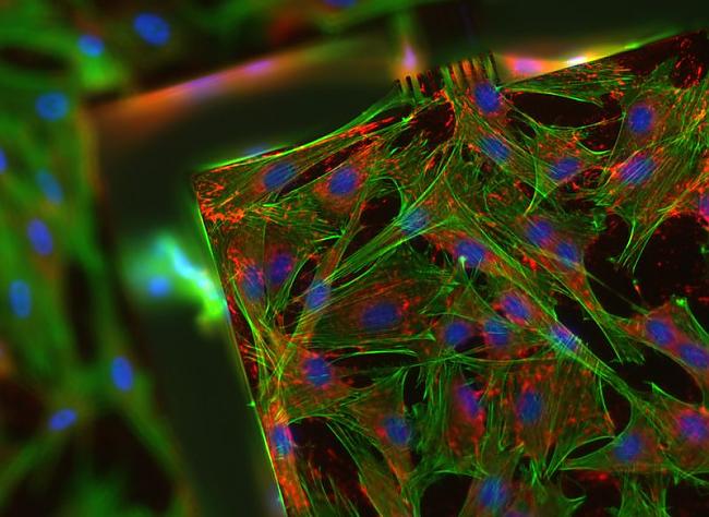Žurkas zemādas šūnas Attēls... Autors: AndOne Mikrofotogrāfija
