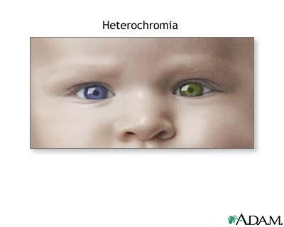  Autors: StealtH Heterochromia