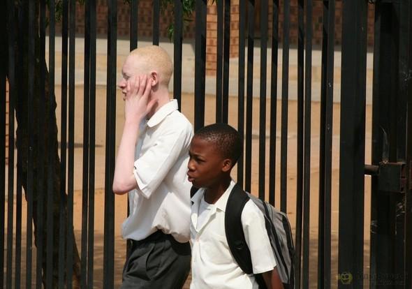  Autors: marju6ka Āfrikas albīni