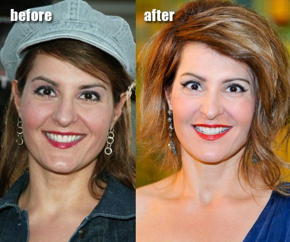 Nia Vardalos Autors: moodway Pirms Un Pēc