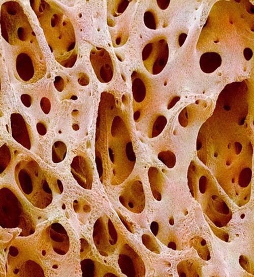 Cilvēka kauls Autors: Tiamo Zem mikroskopa