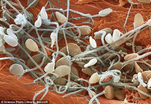 Sperma Autors: Tiamo Zem mikroskopa