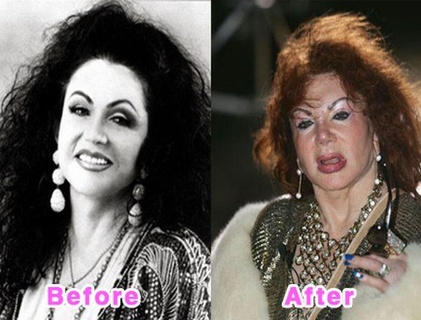 Jackie Stallone Autors: bee62 16 Worst Celebrity Plastic Surgery Disasters part 1