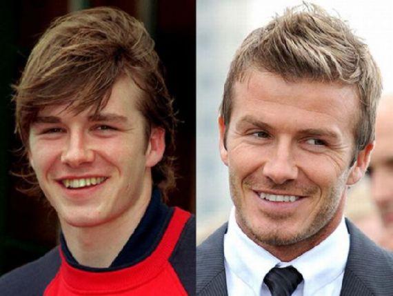David Beckham Autors: MJ Slavenību zobi pirms un pēc!