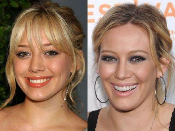 Hilary Duff Autors: MJ Slavenību zobi pirms un pēc!