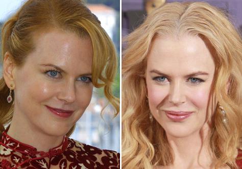 Nicole Kidman veica lūpu... Autors: Simkiwi Slavenības, kuras nemanot veica plastiskās operācijas
