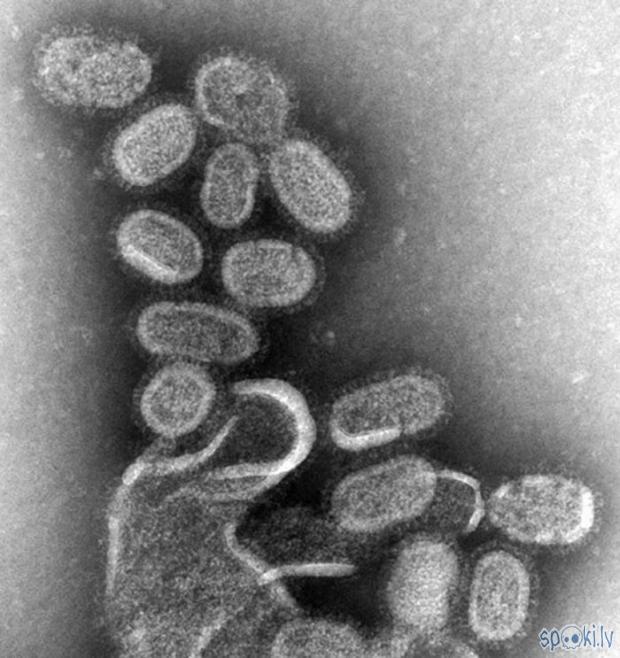 Autors: Le Bagman H1N1 Vīruss (Tautā sauktā cūku gripa)