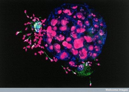 embrions un sperma Autors: Karapietka Cilvēks zem mikroskopa.