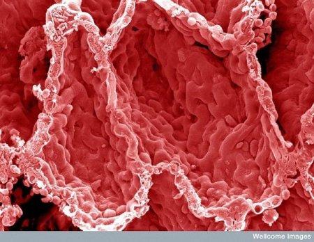 plauscaronu alveolas Autors: Karapietka Cilvēks zem mikroskopa.