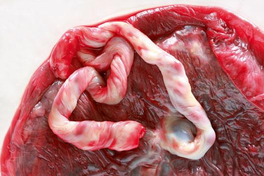 5 Cilvēku placenta Diez vai... Autors: Lācis777 Ko tik nebāž kosmētikā. Top 10