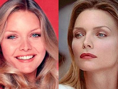 Michelle Pfeiffer nevienam 50... Autors: Fosilija 20 slavenības ar slikto plastisko ķirurģiju