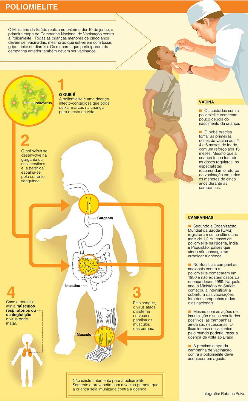 Pirmais poliomielīta bērnu... Autors: Colonel Meow Interesanti fakti no medicīnas.