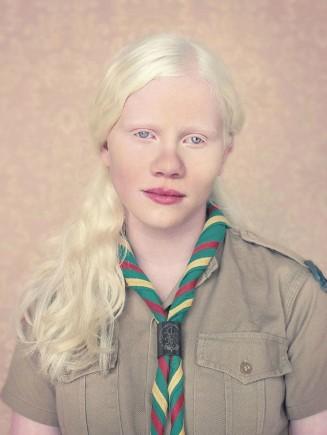  Autors: kjuvertijs Ar albīnismu sirgstošu cilvēku portreti