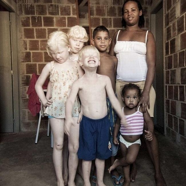 nbspnbspBērnu albīnisma dēļ... Autors: SmallSmooker Melnādaino pāra ģimenē piedzimuši trīs albīni