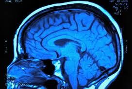 Smadzenēs signāls pārvietojas... Autors: Akumulators Some shit about brain.
