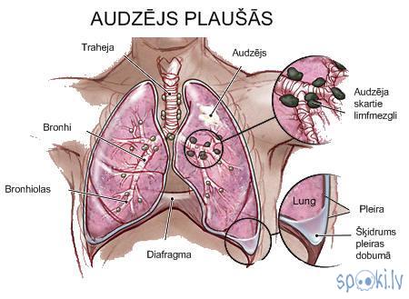 Plāūscaronu Autors: Fosilija Pīpēšana