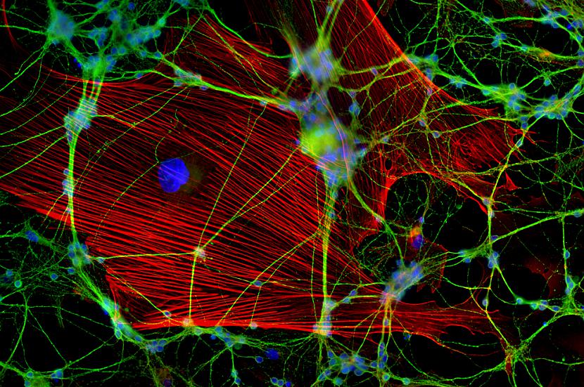 Neironu tīkliņscaron Neroni... Autors: Moonwalker 20 unikāli zinātnes foto