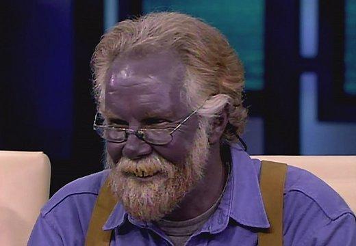 nbspAmerikānis Pols Karasons... Autors: San4uks15 Vīrietis desmit gadu laikā kļuvis koši violets