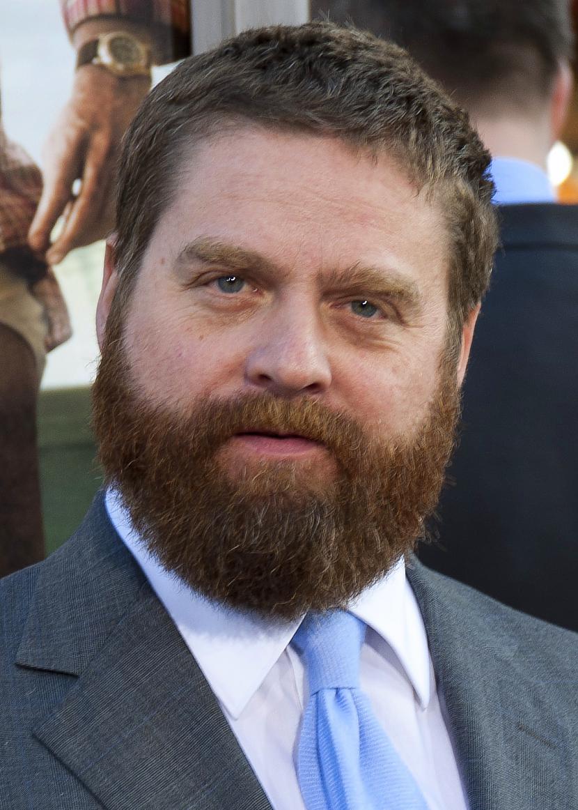 Zaks Galifianakis pēc... Autors: Uldis Siemīte Fakti ! Par slavenībām !