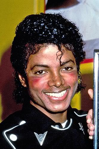 Maiklam bija divas slimības... Autors: MJ Lover Michael Jackson