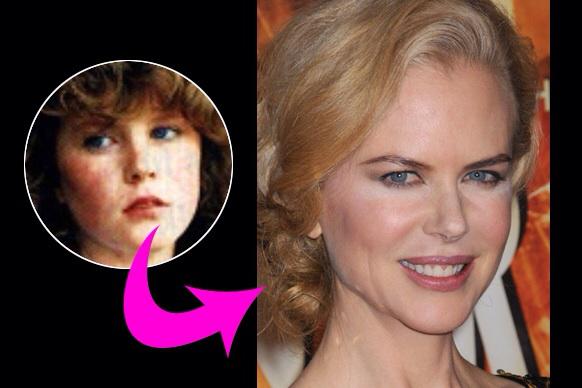 Nicole Kidman 1967 47 gadi... Autors: jackvill Slavenības toreiz un tagad