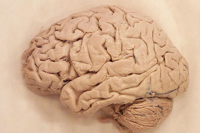 Neļaujiet izžūt smadzenēm Tu... Autors: Fosilija Fakti par smadzenēm un apmatojumu .
