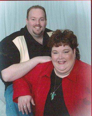 Arī viņas vīrs nolēma... Autors: Fosilija Zaudēja svaru ar operācijas palīdzību!