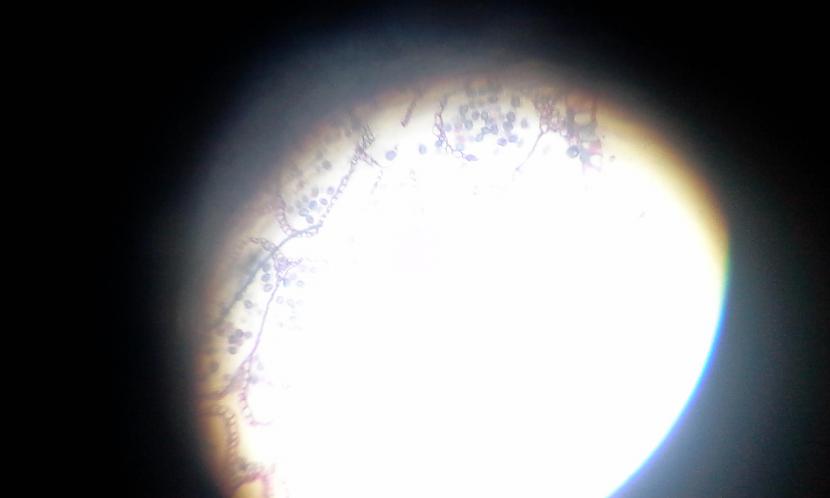 Diemžēl scaroneit vajag... Autors: LeģendāraisDJ Šūnas mikroskopā