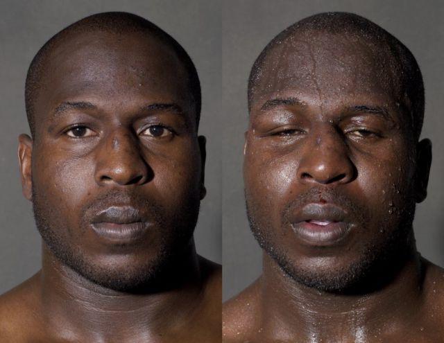 raudnbsp Autors: olološD Bokseru sejas pirms un pēc kautiņiem.
