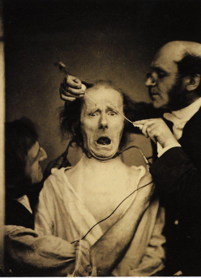 Šajā bildē 1862gadā neirologs... Autors: AntonioGrableto 9 vēsturiskas fotogrāfijas