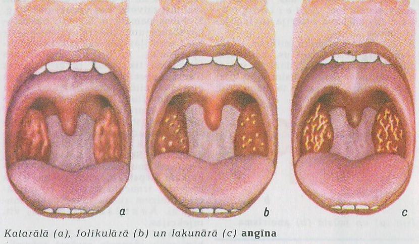 Žāvas navSkābekļa trūkums... Autors: Āboltiņa Kādēļ žāvas ir lipīgas?