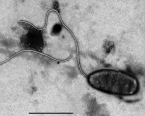 Lūk arī Vibrio harveyi... Autors: im mad cuz u bad Okeānu lielākās mistērijas