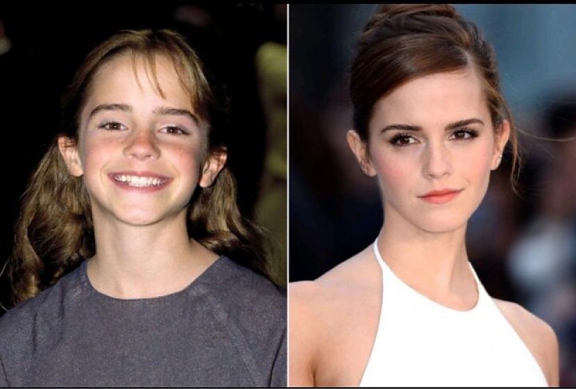 Emma Watsonnbsp Autors: Im a banana Before and after . (Slavenības)