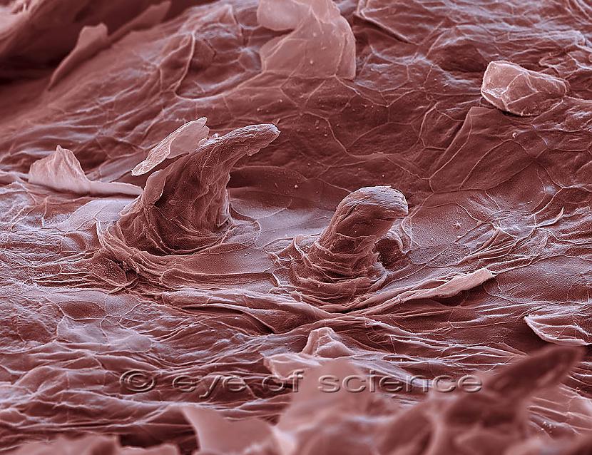  Autors: uzmanību cirvis Tava āda mikroskopā