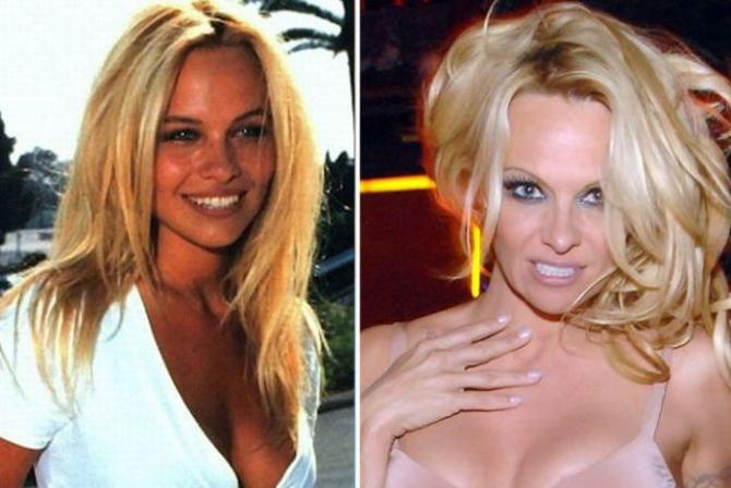 Pamela AndersoneViena no... Autors: Fosilija Šīs slavenības kļuva populāras nejaušības dēļ!